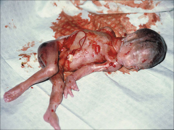 abortion-24-01.jpg